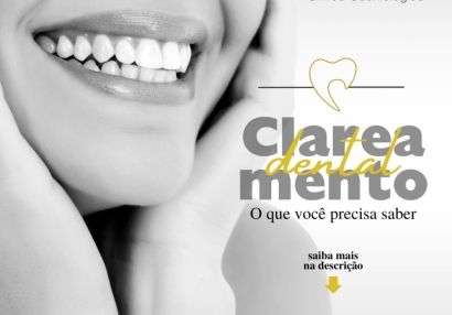 Clareamento Dental